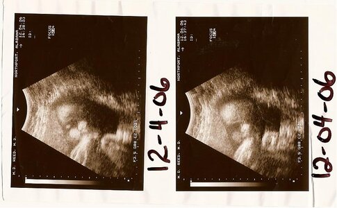 12-4-06 Ultrasound.jpg