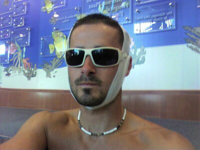 My head gash 001.jpg