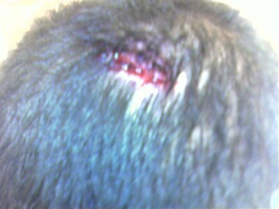 My head gash 004.jpg