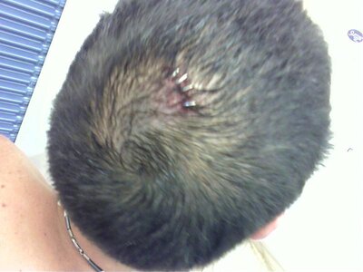 My head gash 010.jpg