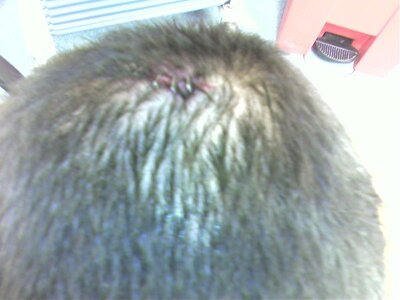 My head gash 009.jpg