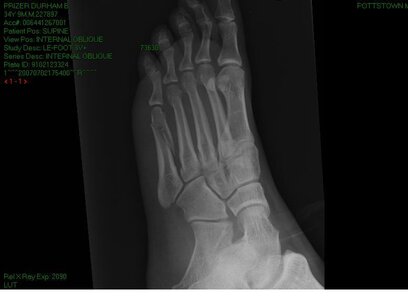 foot 1.JPG