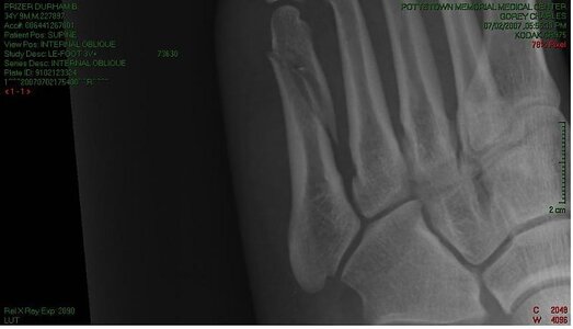 foot 2.jpg