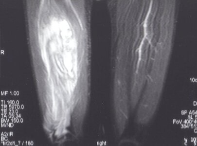 Mike MRI cropped.jpg