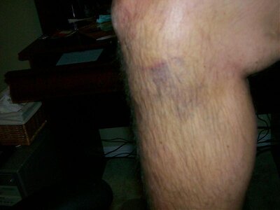 100_0195.jpg