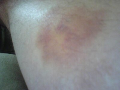 ouch071108-1.jpg