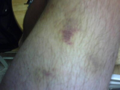ouch 071108.jpg