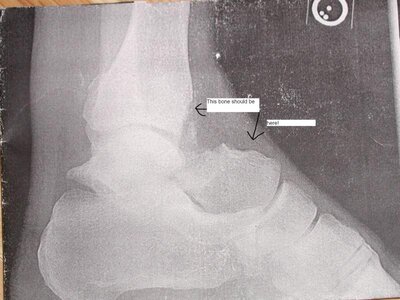 ankle with words.jpg
