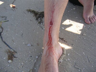 holeinmyleg.jpg