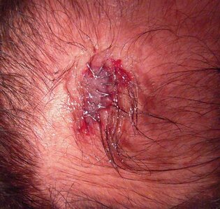 headwound1.jpg