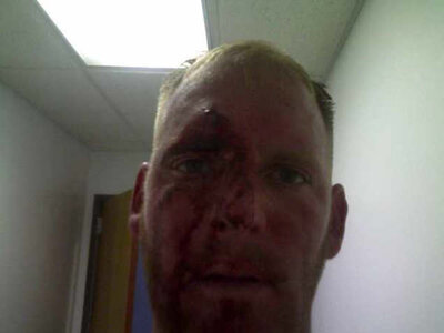 jet ski accident.jpg