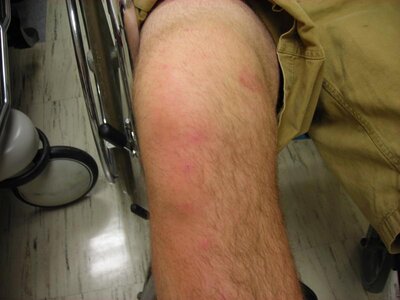 knee,camping pics 015.jpg
