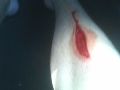the cut that showed the bone 2.jpg